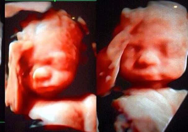 3D models of an unborn child. Picture: BabyBoo/Ross Parry Agency