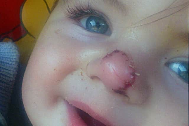 Finlay Bryson whose nose was cut after a Wilkinson mirror allegedly shattered in his face.