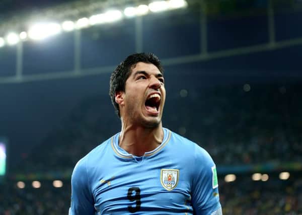 Uruguay's Luis Suarez, as researchers have said that footballers from top clubs have poor dental health, which affects their performance.