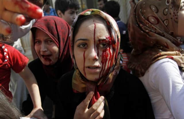 Injured Syrian women arrive at a field hospital after an air strike hit their homes. (Picture: AP Photo/ Khalil Hamra)