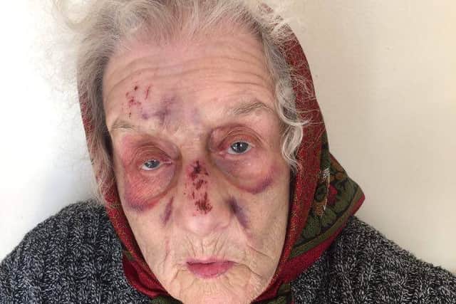 Doreen Gibson, 89, who was made to wait nearly three hours for an ambulance after falling near Rossington Market