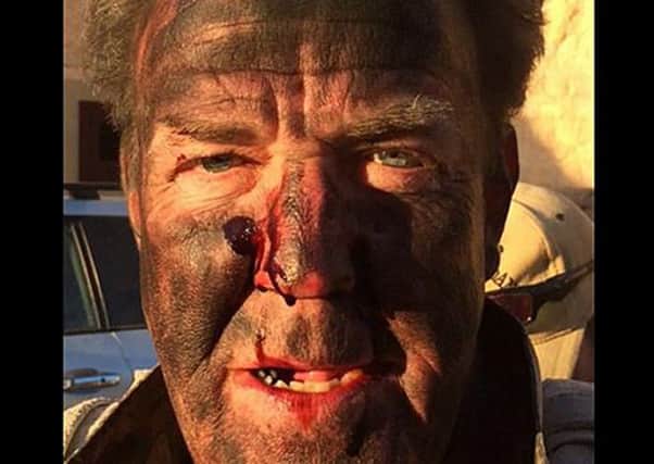 Screen grabbed image taken from the Twitter feed of Jeremy Clarkson as he revealed the results of his "most dangerous stunt" ever: a bloodied nose and blackened face. PRESS ASSOCIATION Photo. Issue date: Saturday April 2, 2016. The former Top Gear host is currently filming his new Amazon Prime motoring show. See PA story SHOWBIZ Clarkson. Photo credit should read: Jeremy Clarkson/Twitter/PA Wire

NOTE TO EDITORS: This handout photo may only be used in for editorial reporting purposes for the contemporaneous illustration of events, things or the people in the image or facts mentioned in the caption. Reuse of the picture may require further permission from the copyright holder.