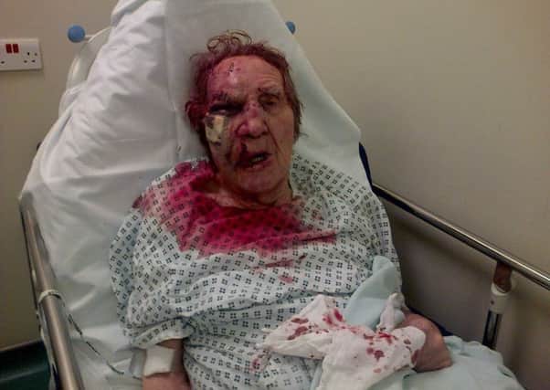 Colin Butlin was left with serious facial injuries after being attacked outside his home