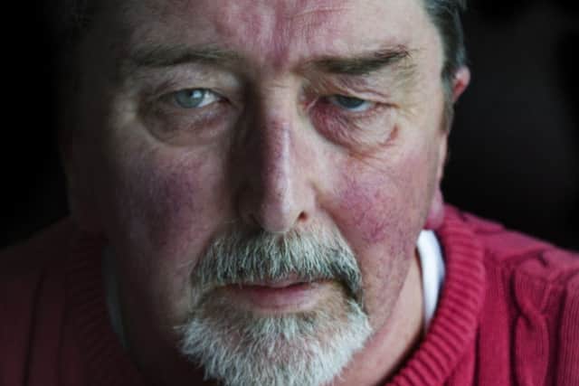 Abuse victim Roy Blanchard, 64