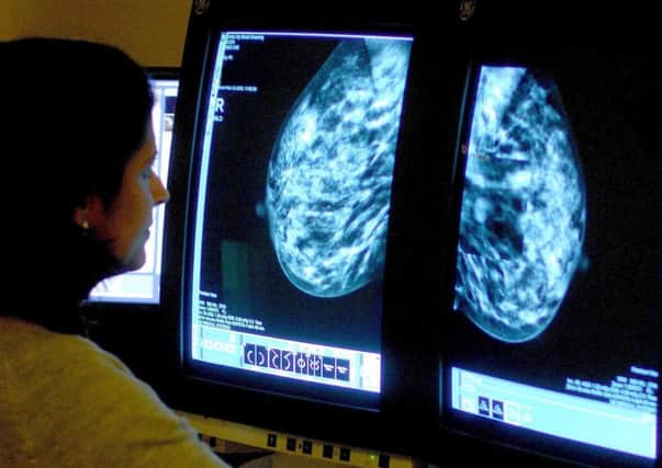 A consultant analyzing a mammogram. Almost two million women a year in England are now screened for breast cancer, figures show.