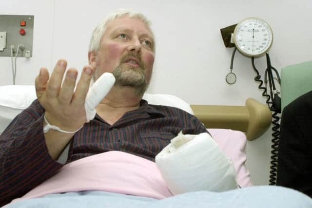 Lib Dem MP Nigel Jones, now Lord Jones of Cheltenham,  recovering after he was attacked in 2000. (PA).