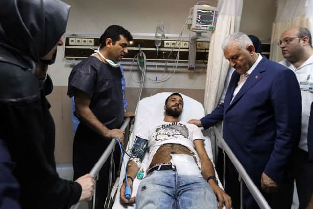 Turkish Prime Minister Binali Yildirim, second right, visits a wounded man at a hospital in Istanbul. Picture: Hakan Goktepe, Prime Ministry Press Office, Pool via AP.