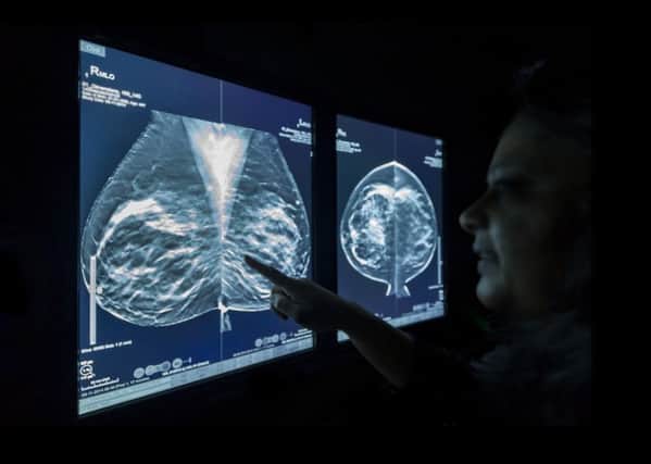 Should more money be spent on drugs to fight breast cancer?