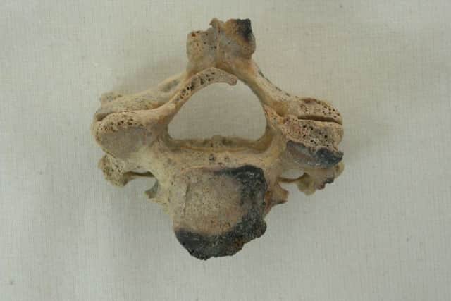 A fourth cervical vertebra, together with the articulating C3, one of a number of human bones excavated from a deserted village in Yorkshire.