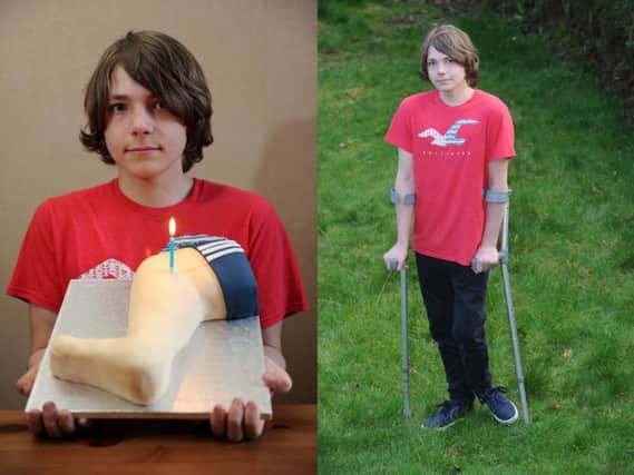 A new start: Thomas Green with his leg cake and on his feet with the aid of crutches.