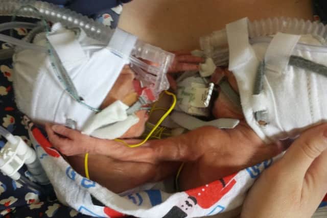 Austin and Rory weighed less than 1kg each when they were born at just 26 weeks