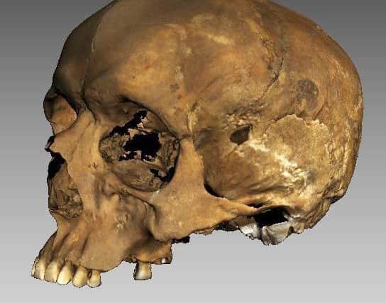 Remains Medieval Priest  found in Lincs.