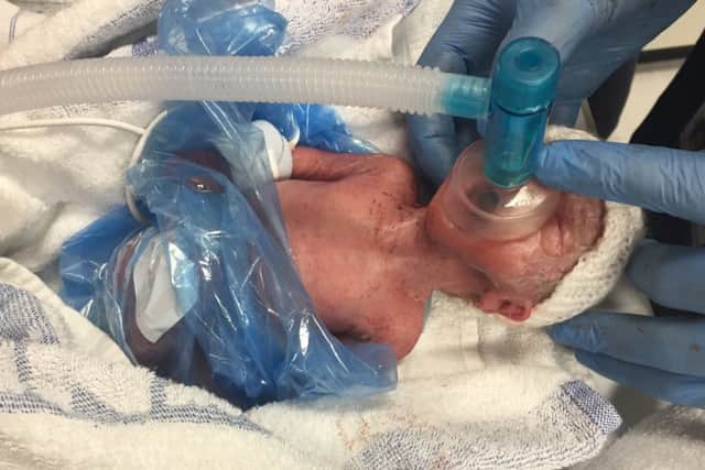 Fighter: Little Esmae Walker born at just 27 weeks is now doing well