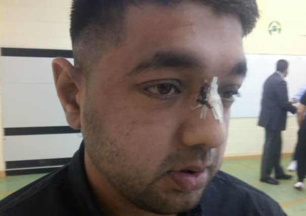 Leeds taxi driver Awais Hussain was badly injured by a yob throwing stones at his cab.