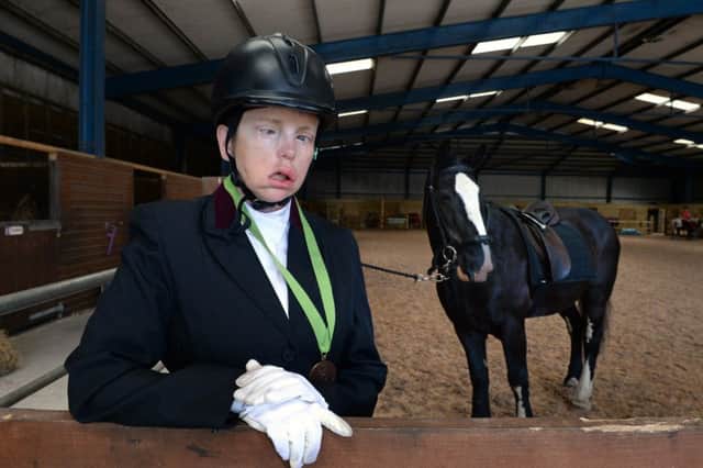 Anna Lickley, who is deaf and blind and this weekend competed in the  national RDA (Riding for the Disabled Association) championships, pictured with Robbie at the St Ives Riding for the Disabled, Bingley. 
17 July 2017. Picture Bruce Rollinson