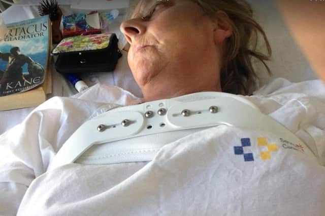 Marlene was left in a back brace after fracturing vertebrae