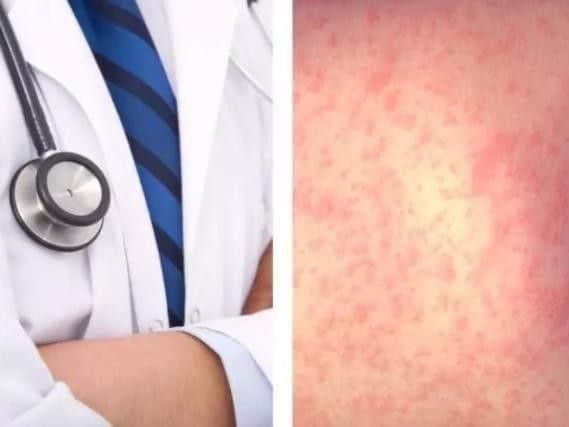 Health officials have warned of a new measles outbreak in West Yorkshire.