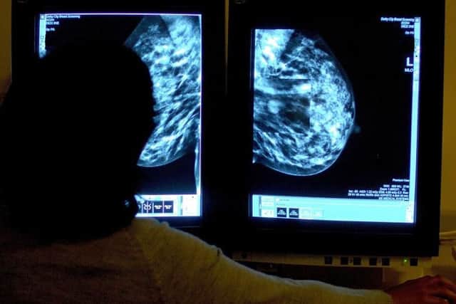 File picture of a consultant studying a mammogram. Hundreds of thousands of women were not invited for routine breast cancer screening due to an administrative error, it has been reported.